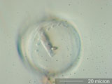 Diatom, Stephanodiscus